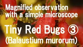Magnified observation with a simple microscope: Tiny Red Bugs(Balaustium murorum)3