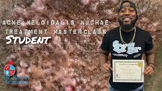 Acne Keloidalis Nuchae Treatment MasterClass  Student Testimony