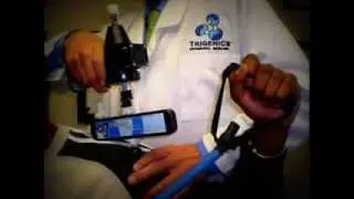 FROZEN SHOULDER - FIXED IN ONE MINUTE. The Oolo-Austin Trigenics Procedure for Adhesive Capsulitis