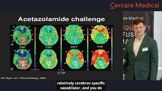 Cerebral Hemodynamics in Moyamoya – Dr. Rikard Grankvist