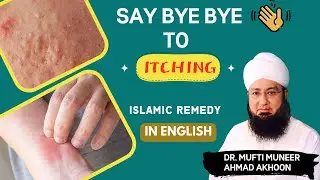 Powerful Islamic Remedy for Skin Itching & Rashes Problem Solution | Say Bye Bye To Itching