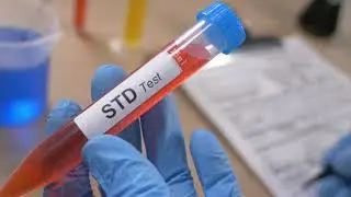 Hepatitis C Screening