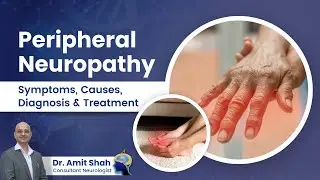 What is Peripheral Neuropathy? | Understanding its Causes, Symptoms, Diagnosis and Treatment Options