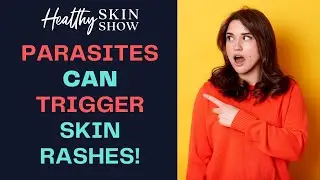 Do PARASITES Cause Skin Rashes?! | Jennifer Fugo