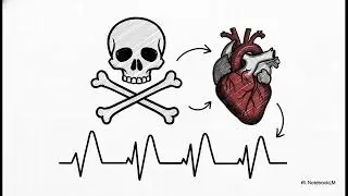 STEMI Localization Masterclass: ECG Leads & The Heart Map [Board Exam Guide]