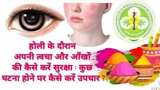 How to protect your skin and eyes during Holi : What to do if something happens?