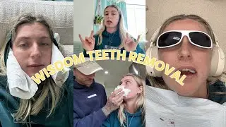 Wisdom teeth removal while awake, infected gum and the best boyfriend