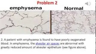 Diffusion and Osmosis problem 2 video
