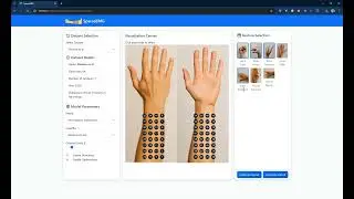 SparseEMG: Computational Design of Sparse EMG Layouts for Sensing Gestures