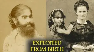 Печальная история любимой бородатой леди Америки | Энни Джонс Эллиот