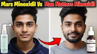 Man Matters vs Mars Minoxidil | Which One Grows a Better Beard | Minoxidil Beard growth |