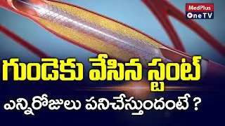 How Long Does a Heart Stent Last? | Dr.Kiran Kumar @MedPlusONETV
