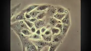 Myxomyceten - Pilz und Am&ouml;be - Physarum, eine Riesenzelle, ein echter Schleimpilz