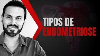 Conheça os TIPOS DE ENDOMETRIOSE. |  Dr. André Vinícius