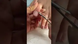Learn to use a curved scissors to easily cut dead skin#Bending shear#Unzip the video#Dead