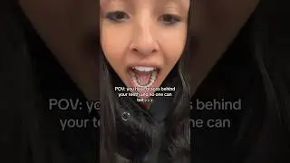 You Would NEVER Know She Had These In Her Mouth! 🤫🦷