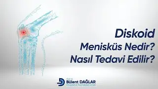 Diskoid Menisk&uuml;s