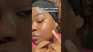 Fade Dark Spots FAST! | The Best Serums To Fade Hyperpigmentation