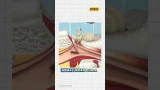 Apa yang terjadi jika serangga masuk telinga
