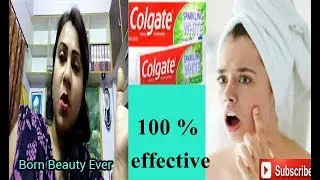 ** Toothpaste hacks & tips to cure pimples & acne ** ## ll Born Beauty Ever