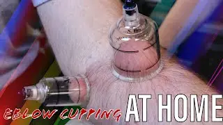 Elbow Cupping After Pitching | Cupping Therapy at Home
