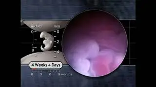 The Biology of Prenatal Development: Heart at 4 Weeks