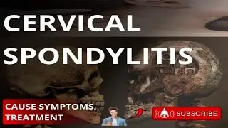 Neck Pain|| Cervical Spondylitis Symptoms, Causes, & Treatment| Neck Arthritis | Cervical