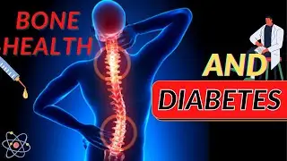 DIABETES AND BONE HEALTH | CAN DIABETES CAUSE JOINT PAIN | CURE91