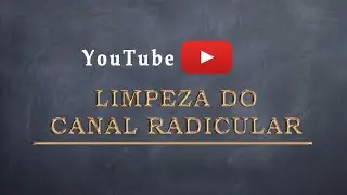 LIMPEZA DO CANAL RADICULAR   CLEANING THE ROOT CANAL