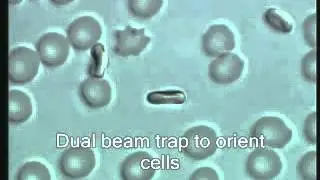 ZEISS Laser Capture Microdissection (LCM): Trap, move and sort cells with PALM MicroTweezers