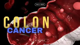 Colon Cancer Unveiled: Shocking Facts & Lifesaving Tips You NEED to Know! 🩺