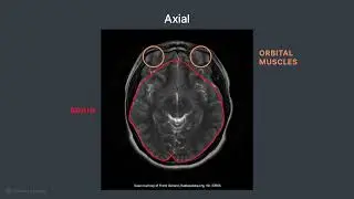 Patient Positioning and Protocol for a Routine Brain MRI