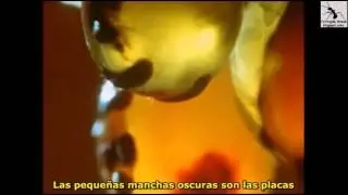 Formigas Pote-de-Mel - Honeypot Ant (Myrmecocystus sp)