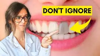 Do You Need a Root Canal? These are Warning Signs