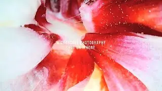 Microscope photography Shot on iPhone