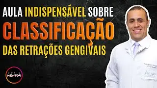 CLASSIFICAÇÃO DAS RETRAÇÕES GENGIVAIS ------PROF: RENATO VASCONCELOS