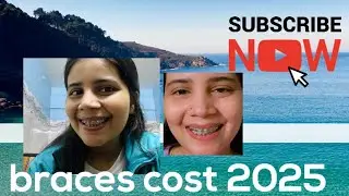 Braces price 2025#teethbraces #teeth #braces #viral #trending #vlog #viralvideo #top #dentalbraces 