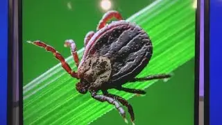 A tick bite that causes a rare virus | Dig In 2 It