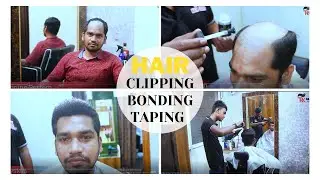 Hair patch, clipping, tapping, bonding, fixing, hair replacement by RK Hair Studio at 6999/-