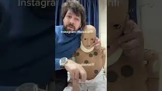 عضة الانسان و خطورتها و كيفية التعامل معها #عضة_الانسان #humanbite