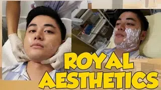 INSTANT V-SHAPE FACE By Royal Aesthetics