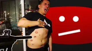 THIS VIDEO WAS DELETED