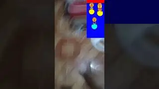 My Toe Hurt By Noodle And Pals Hopper Ball