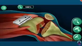 Knee Surgery ASMR games | #1080p #ASMR #nightfurycr7gaming #medical