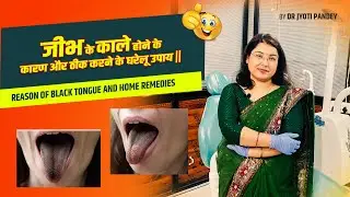 Causes of black tongue and home remedies to cure it ||