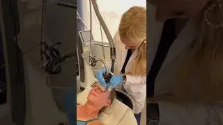 Tightening upper eyelids with Fraxel #antiaging #over40 #tightening