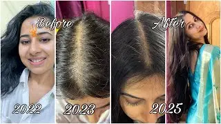 8 Hair Growth Serums for Reduced Hair fall & Hair Growth ( what didn&rsquo;t work? ) 
