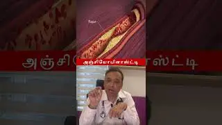 அஞ்சியோபிளாஸ்ட்டி - EECP நிபுணர் விளக்கினார்