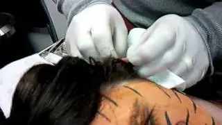 Getting my dermal punch (up close vid)