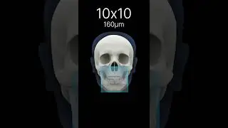 Tackle more dentistry, RAYSCAN &alpha;-3D Edge!
